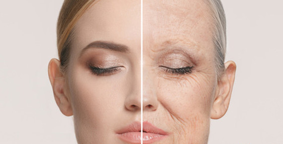 Facelifting